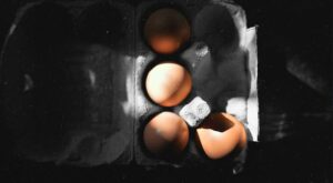 How eggs affect gout: Safety and recipe ideas