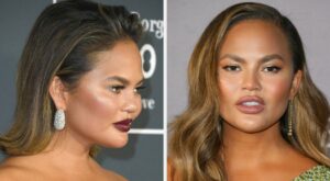 Chrissy Teigen Responds To Comment About Her New Face – BuzzFeed