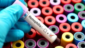 World Haemophilia Day: Here’s everything you should know about this rare disorder