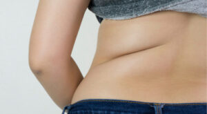 Dietitians Agree: This Is The Best Way To Get Rid Of Stomach & Back Fat